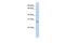 Insulin Like Growth Factor Binding Protein 4 antibody, PA5-42753, Invitrogen Antibodies, Western Blot image 