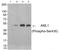 Aml1 antibody, GTX55347, GeneTex, Western Blot image 