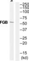 Fibrinogen Beta Chain antibody, abx015202, Abbexa, Western Blot image 