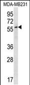 Zinc Finger Protein 506 antibody, PA5-48445, Invitrogen Antibodies, Western Blot image 