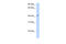 Solute Carrier Family 25 Member 24 antibody, 29-926, ProSci, Western Blot image 