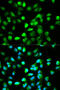 Transcription Factor 4 antibody, STJ25793, St John