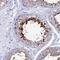 Heat Shock Protein Family A (Hsp70) Member 1 Like antibody, NBP1-92012, Novus Biologicals, Immunohistochemistry paraffin image 