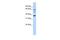 UDP Glucuronosyltransferase Family 1 Member A9 antibody, PA5-42208, Invitrogen Antibodies, Western Blot image 