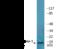 Stathmin 1 antibody, EKC2523, Boster Biological Technology, Western Blot image 