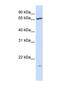 Phosphatidylinositol Glycan Anchor Biosynthesis Class T antibody, NBP1-69585, Novus Biologicals, Western Blot image 