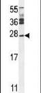 Josephin Domain Containing 2 antibody, PA5-24098, Invitrogen Antibodies, Western Blot image 