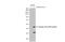 Dengue virus antibody, GTX630556, GeneTex, Western Blot image 