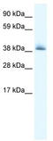 Potassium Channel Tetramerization Domain Containing 13 antibody, TA338781, Origene, Western Blot image 