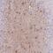 Zinc Finger Protein 311 antibody, PA5-62209, Invitrogen Antibodies, Immunohistochemistry frozen image 