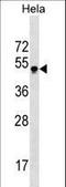 Gastrulation Brain Homeobox 2 antibody, LS-B10661, Lifespan Biosciences, Western Blot image 