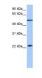 Protein Inhibitor Of Activated STAT 2 antibody, orb330732, Biorbyt, Western Blot image 