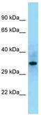 Src Homology 2 Domain Containing F antibody, TA343294, Origene, Western Blot image 