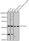 General Transcription Factor IIH Subunit 4 antibody, A8425, ABclonal Technology, Western Blot image 