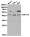 Actin Related Protein 2/3 Complex Subunit 1A antibody, TA326912, Origene, Western Blot image 