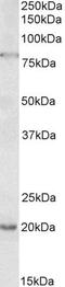 2'-5'-Oligoadenylate Synthetase 2 antibody, PA5-37878, Invitrogen Antibodies, Western Blot image 