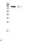 Transient Receptor Potential Cation Channel Subfamily V Member 4 antibody, LS-C813763, Lifespan Biosciences, Western Blot image 