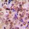 Metastasis Associated 1 antibody, orb393115, Biorbyt, Immunohistochemistry paraffin image 
