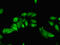 Thyroid Hormone Receptor Interactor 4 antibody, LS-C679904, Lifespan Biosciences, Immunofluorescence image 