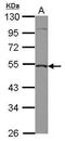 Caspase 2 antibody, PA5-29156, Invitrogen Antibodies, Western Blot image 