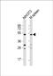 Mixed lineage kinase domain-like protein antibody, PA5-71886, Invitrogen Antibodies, Western Blot image 