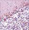 Retinoic Acid Receptor Alpha antibody, LS-C162444, Lifespan Biosciences, Immunohistochemistry frozen image 