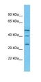 Pentraxin 4 antibody, orb326592, Biorbyt, Western Blot image 