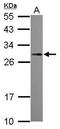 Platelet Derived Growth Factor Subunit B antibody, GTX100683, GeneTex, Western Blot image 