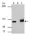 Poly(ADP-Ribose) Polymerase 1 antibody, GTX112839, GeneTex, Immunoprecipitation image 
