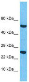 RAS Related 2 antibody, TA334999, Origene, Western Blot image 