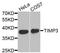 TIMP Metallopeptidase Inhibitor 3 antibody, STJ25854, St John