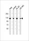 E3 ubiquitin-protein ligase BRE1A antibody, M03457-2, Boster Biological Technology, Western Blot image 