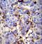 Prolactin Induced Protein antibody, LS-C166408, Lifespan Biosciences, Immunohistochemistry frozen image 