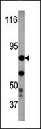 Inhibitor Of Nuclear Factor Kappa B Kinase Subunit Beta antibody, AP12624PU-N, Origene, Western Blot image 