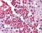 RuvB Like AAA ATPase 2 antibody, NBP1-33373, Novus Biologicals, Immunohistochemistry paraffin image 