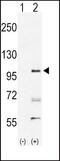 EPH Receptor A2 antibody, PA5-14574, Invitrogen Antibodies, Western Blot image 