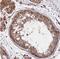Mitochondrial Poly(A) Polymerase antibody, NBP1-83856, Novus Biologicals, Immunohistochemistry paraffin image 
