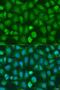 Chromodomain Helicase DNA Binding Protein 1 antibody, LS-C750010, Lifespan Biosciences, Immunofluorescence image 