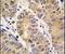 Matrix Metallopeptidase 13 antibody, PA5-13182, Invitrogen Antibodies, Immunohistochemistry frozen image 