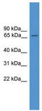 Activating Transcription Factor 6 antibody, TA330233, Origene, Western Blot image 