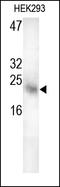 S100 Calcium Binding Protein P antibody, 251909, Abbiotec, Western Blot image 