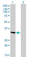 SPARC antibody, LS-C198252, Lifespan Biosciences, Western Blot image 