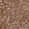 Tonsoku Like, DNA Repair Protein antibody, NBP2-48847, Novus Biologicals, Immunohistochemistry paraffin image 