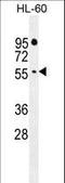 F-Box And WD Repeat Domain Containing 11 antibody, LS-C166093, Lifespan Biosciences, Western Blot image 