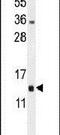 Mitochondrial Ribosomal Protein L51 antibody, PA5-24414, Invitrogen Antibodies, Western Blot image 