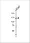 Transient Receptor Potential Cation Channel Subfamily M Member 8 antibody, A01002, Boster Biological Technology, Western Blot image 