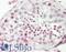 Cell Division Cycle 20 antibody, LS-B12892, Lifespan Biosciences, Immunohistochemistry paraffin image 