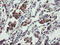 TPD52 Like 3 antibody, M16435, Boster Biological Technology, Immunohistochemistry paraffin image 