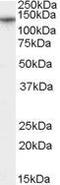 Calcium Voltage-Gated Channel Auxiliary Subunit Alpha2delta 1 antibody, GTX89045, GeneTex, Western Blot image 