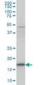 TRNA Splicing Endonuclease Subunit 15 antibody, H00116461-M01, Novus Biologicals, Western Blot image 